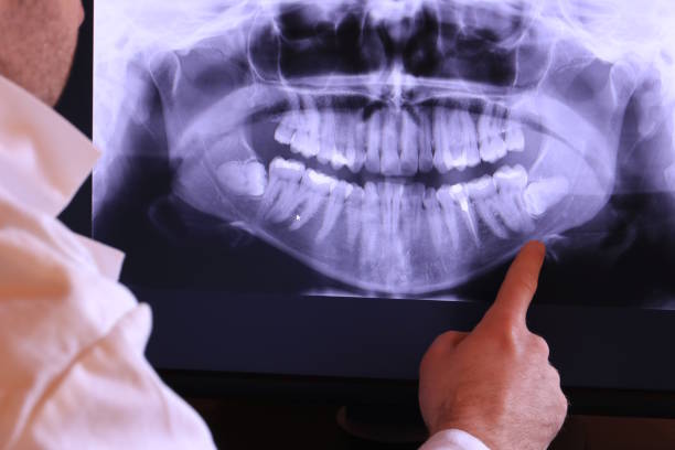 Best Emergency Dental Services Near Me  in Fort Montgomery, NY